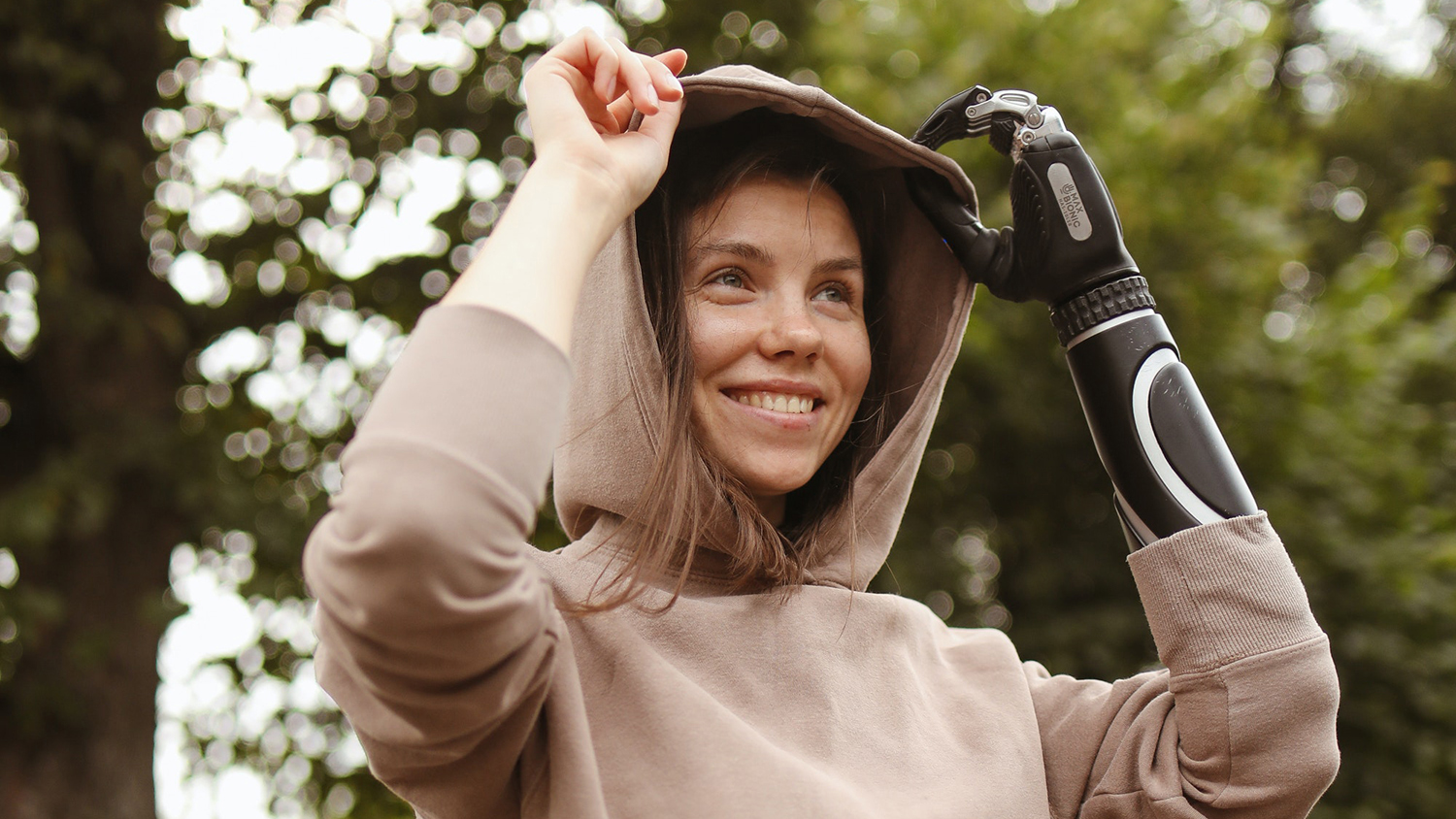 γυναίκα με προσθετικό χέρι – ασφάλιση αναπηρίας γυναίκα με προσθετικό χέρι – ασφάλιση αναπηρίας